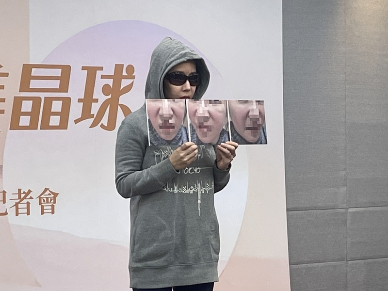施打了「少女針」假貨的害者人林小姐18日於記者會語帶啜泣,闡述當時打到假貨的經驗。(Photo by 簡嘉佑/台灣醒報)