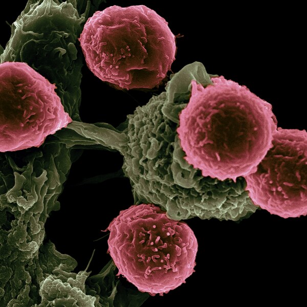 一項醫學研究指出,加速老化與癌症風險增加有關。(Photo by National Cancer Institute on Unsplash under C.C License)