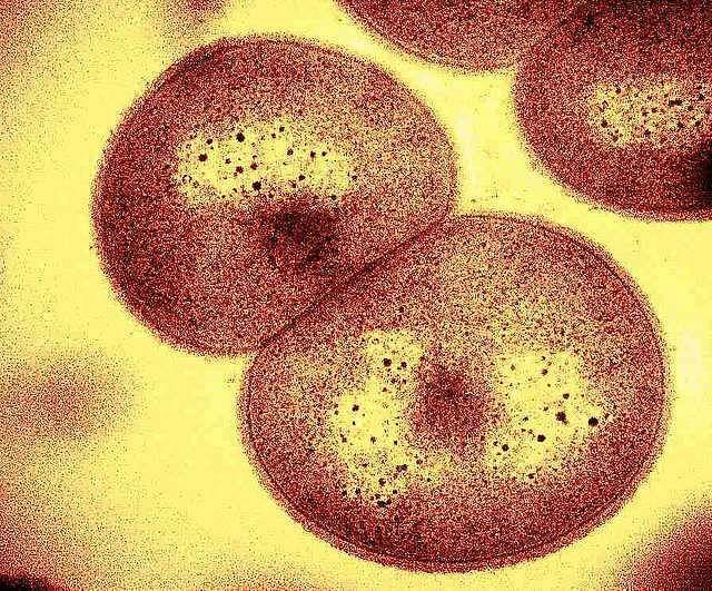 科學家近年來對研究抗輻射微生物相當有興趣,盼藉此讓人類在太空能活動更長時間,進行高難度任務。(Wikimedia Commons 細菌示意圖)